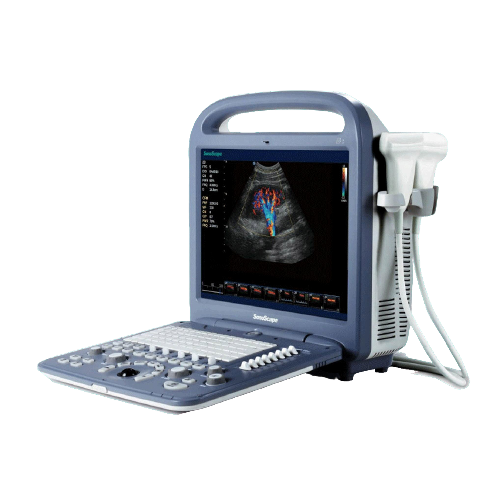 Ecógrafo de Alta Precisión